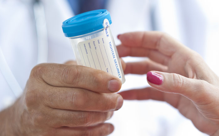 diagnóstico del cáncer de vejiga